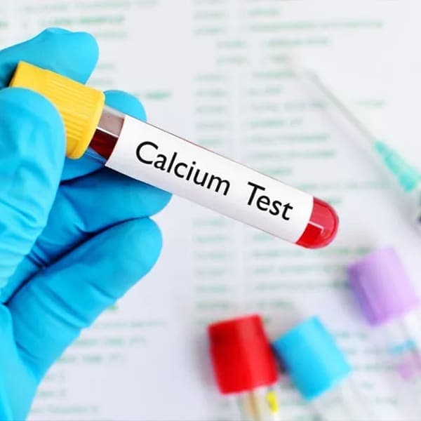 Calcium